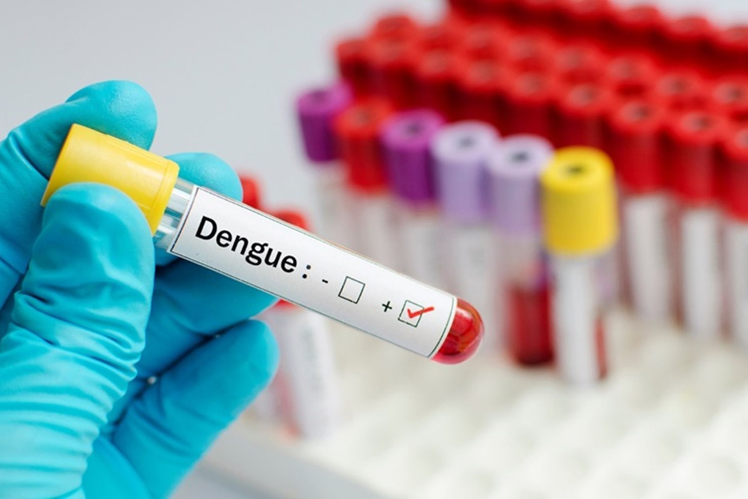 Epidemia di dengue: una nuova sfida per l’America Latina